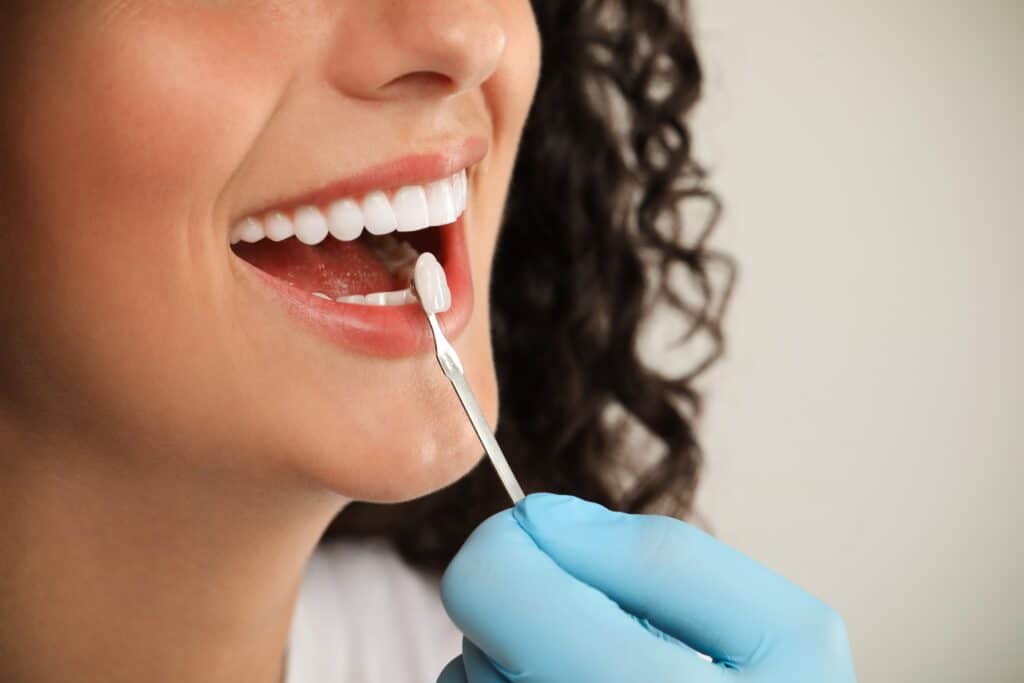 Dental implanst De Soto